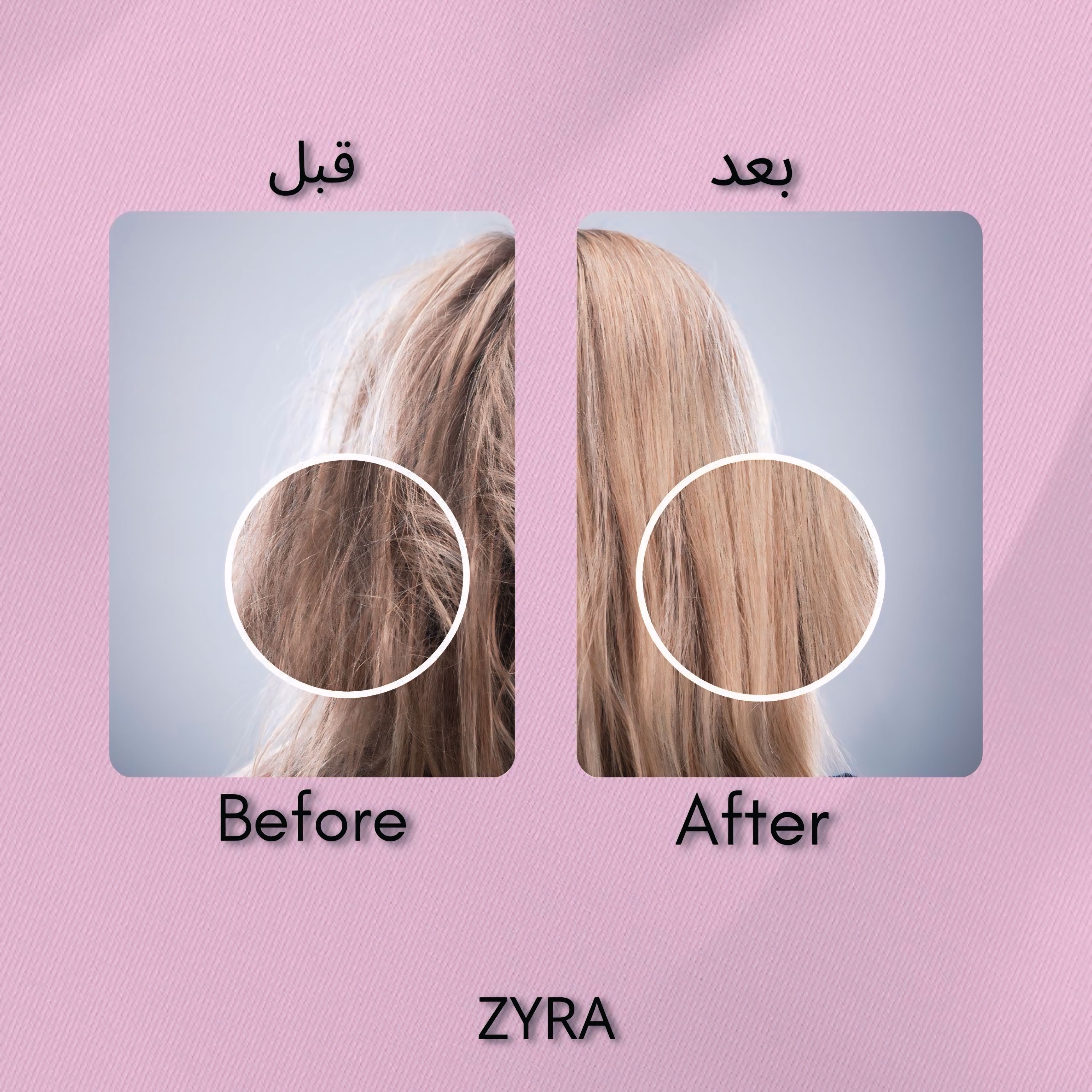 تنظيف مضاد للكهرباء الساكنة